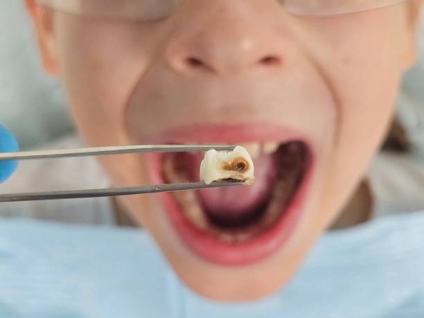 Best Tooth Pain Emergency Relief  in Briggs, OK